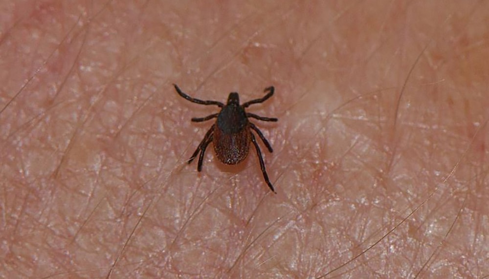5.12.17 Lyme Disease MapFEAT